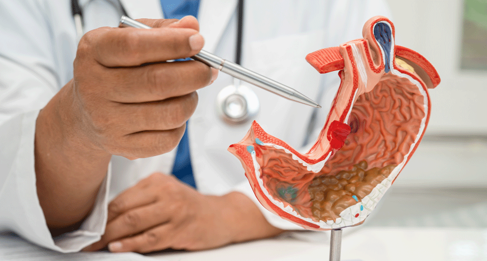 Doctors hand holding pen and pointing at model stomach