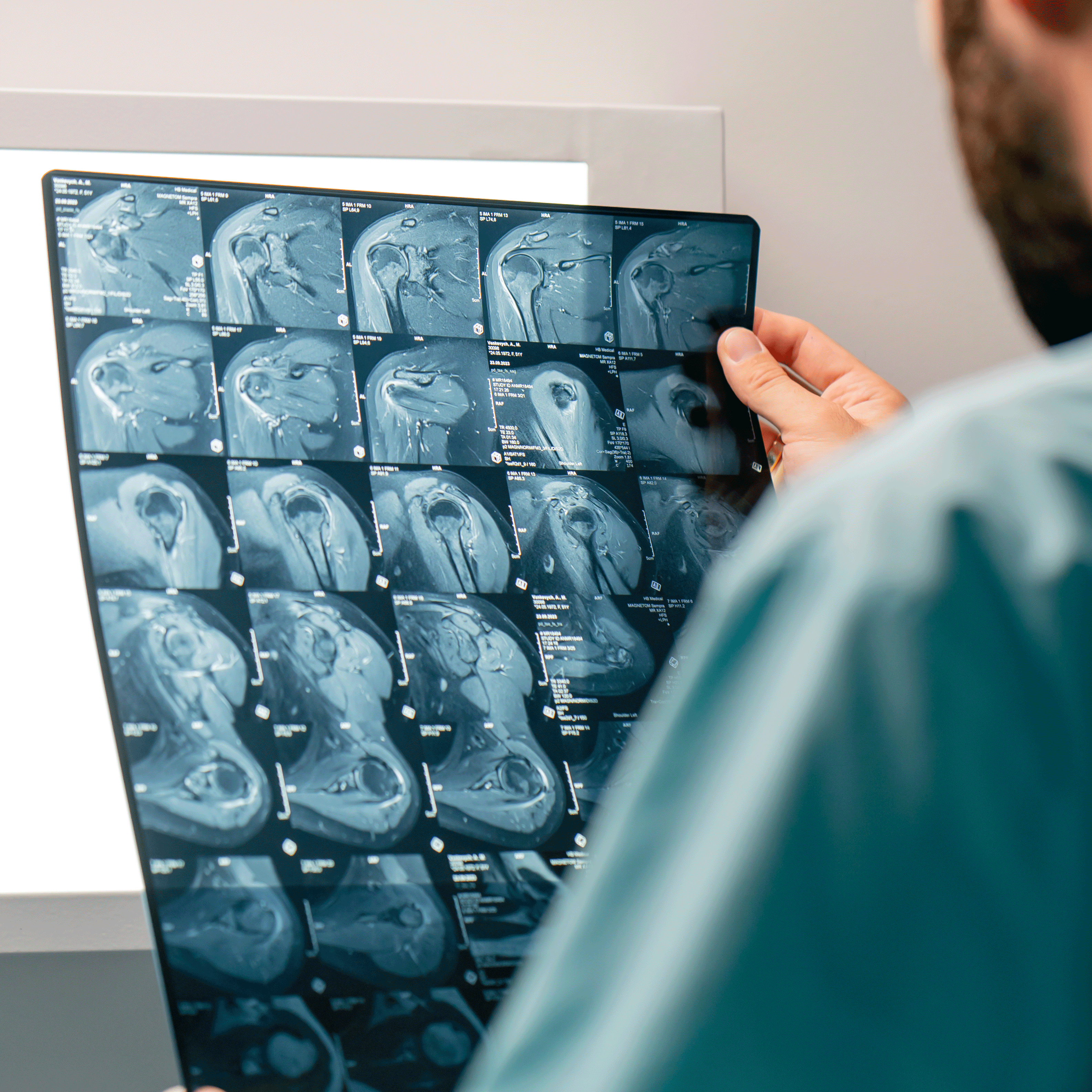 Hands holding MRI scan results against light board