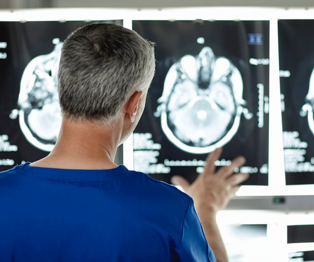 Back view of radiologist looking at brain scan