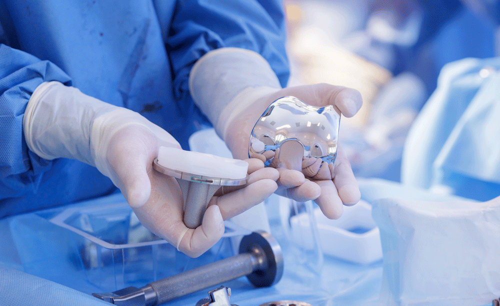 Hands holding knee replacement pieces in surgery